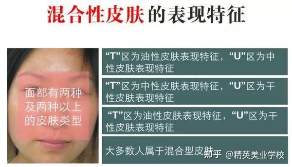 应对方案 混合性皮肤要区分干性皮肤区域和油性皮肤区域,分别护理.