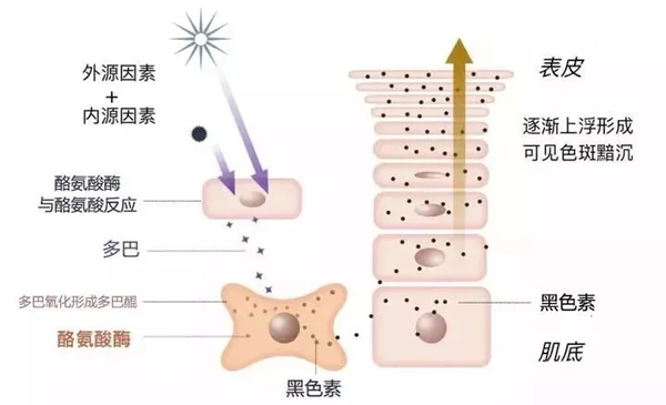 黑色素的形成