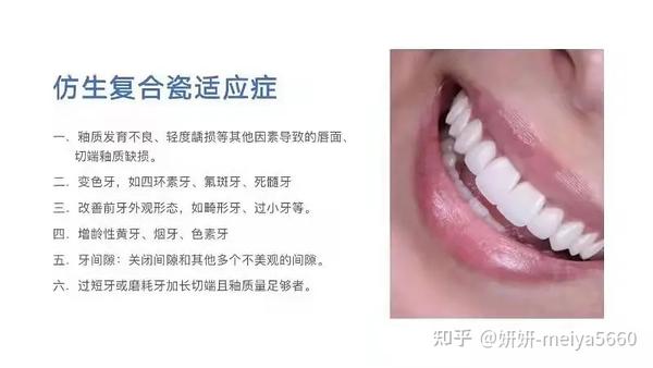 牙齿美白有几种方式?牙齿美白哪种方法好?