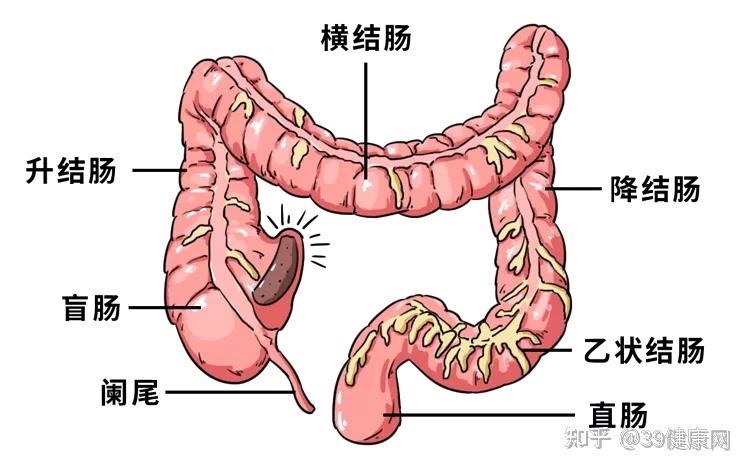 广东一女子治便秘服用2年肠清茶肠子变黑可能是哪些原因导致的如何