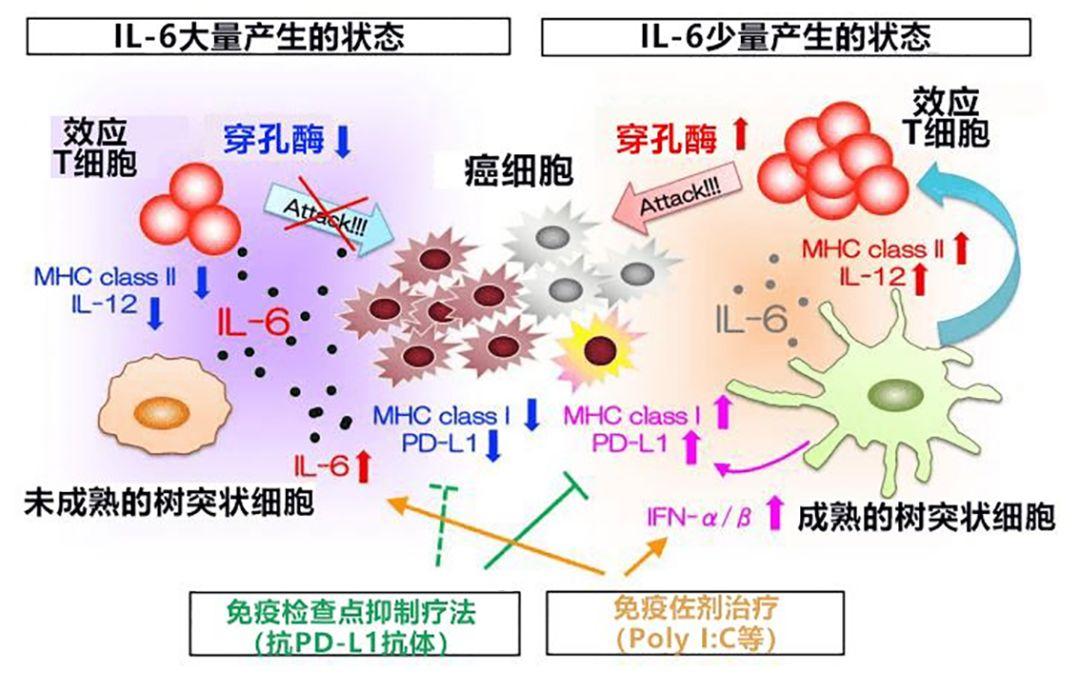 日本查清促进大肠癌肝转移新控制机制,阻断il-6信号有