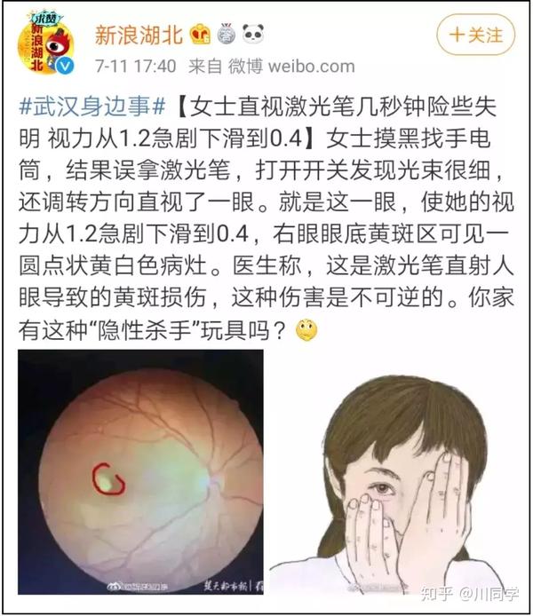 或许有人会问: 这激光笔看起来丝毫不起眼 怎么会对黄斑造成巨大危害