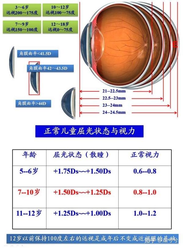 关于近视眼眼轴