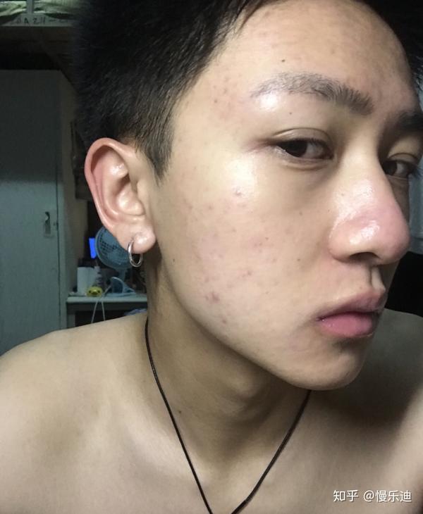 五官好看,皮肤差是什么体验?