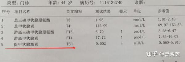 症状模糊,误诊率高,女性35岁以上要注意了,别把甲减当成亚健康