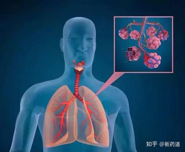 这主要是因为肺癌不痛不痒,即使有一些身体表现,很多人也忽视了,从而
