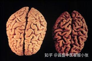 你被小脑萎缩折腾多久了