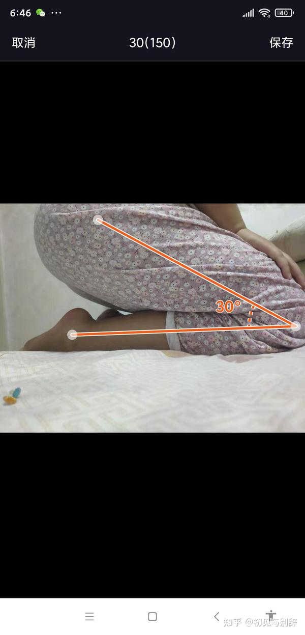 至今十天,角度增加到被动150,主动120.145°以后开始腘窝疼.