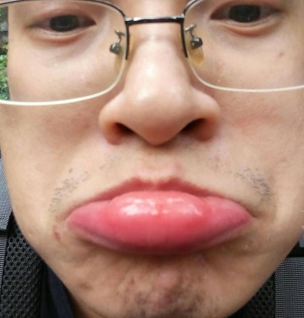 被蜜蜂蜇是什么体验?