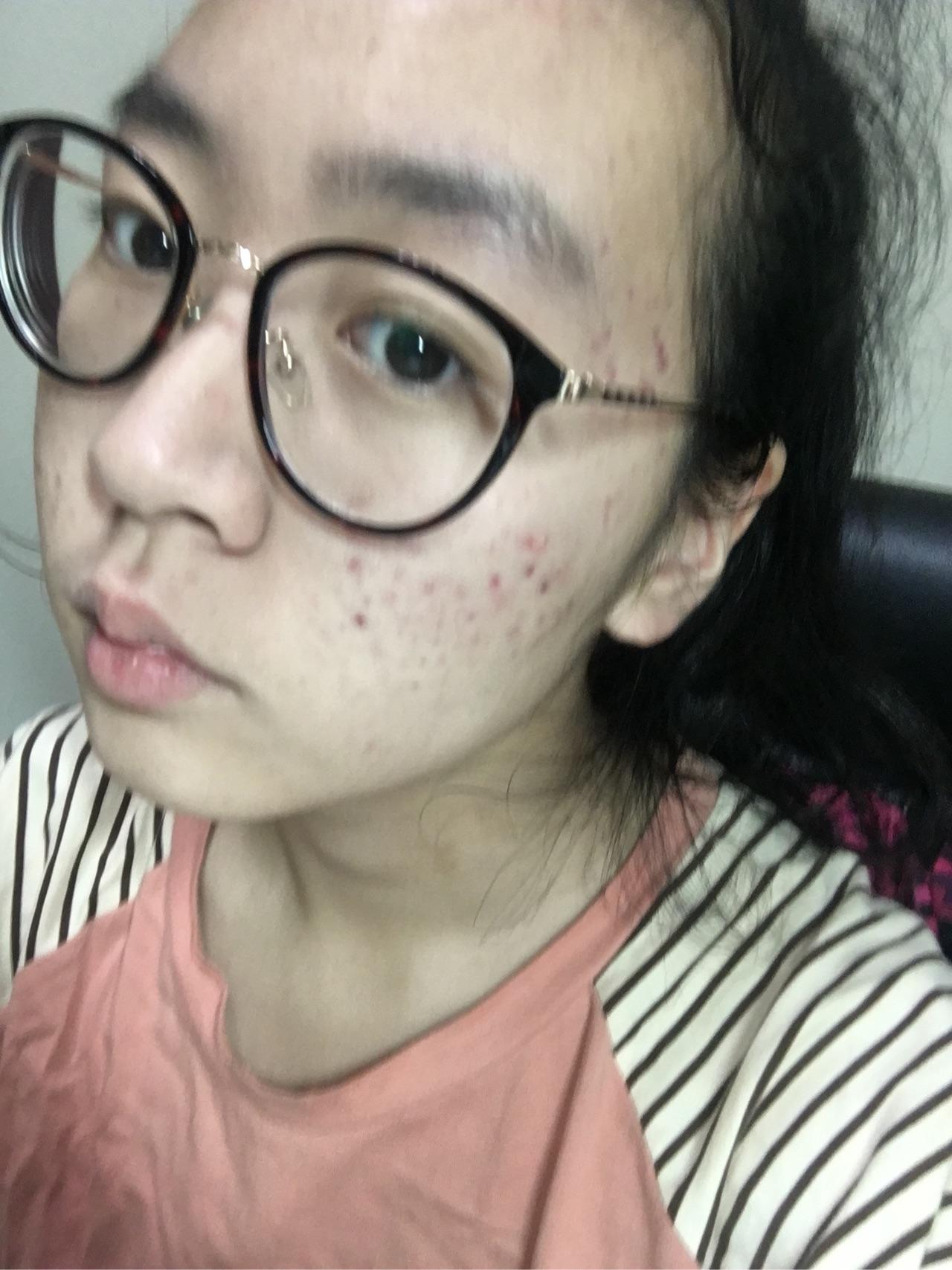 形状再漂亮的女生是不是长了一脸痘都被嫌弃女生五官阴不同唇图片