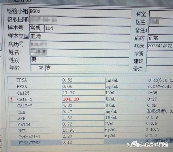 贫血竟会导致肿瘤标志物ca153异常升高