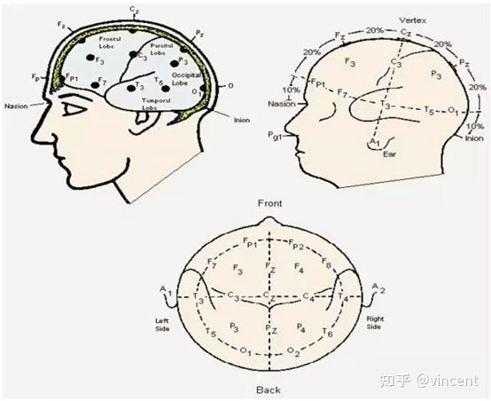 监测脑活动的eeg: 一般患者脑电图电极位置采用10~20国际命名法(如下