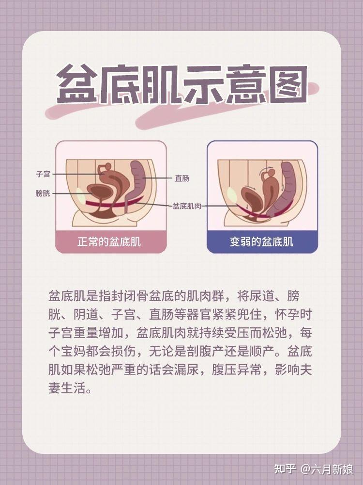 产后修复篇盆底肌修复