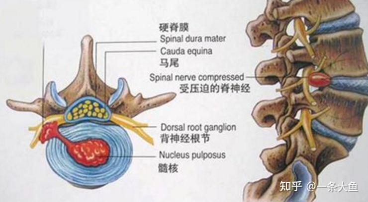 马尾神经为什么那么脆弱?容易受到压迫或损伤呢?