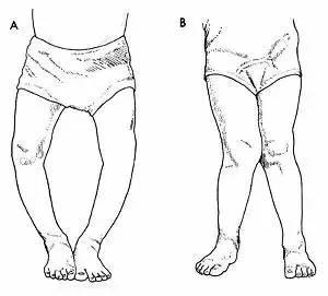"跪坐",就是腿向下折坐姿,大多数在宝宝出生后,腿脚都不太直,有一定