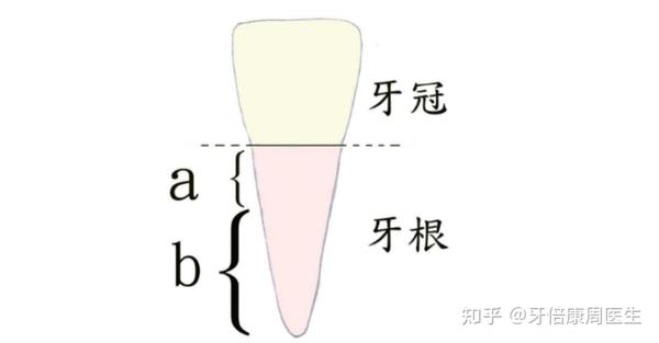 假如被折的牙根部位靠近牙龈,则可拔除牙冠部,保留根部,根管治疗后再