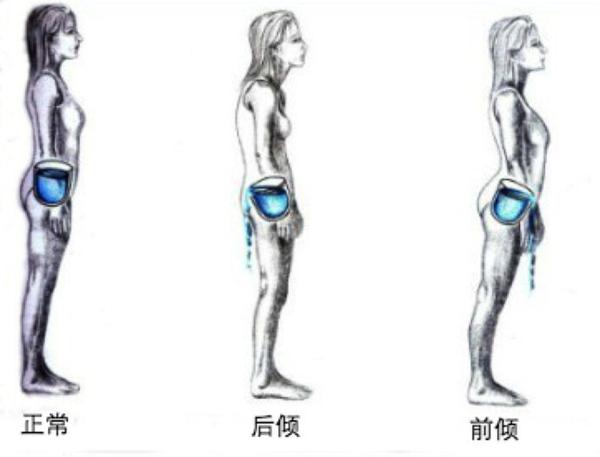 1,骨盆评估完全指南