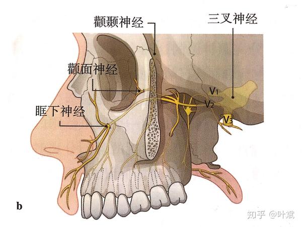 检查眶下孔的位置,应仔细雕刻和安放假体,不能压迫或干扰眶下神经