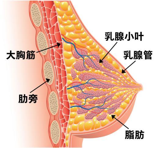 乳腺癌还有一个阶段称为"0期癌症"