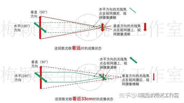 散光300度但视力08看得清楚为什么要戴眼镜