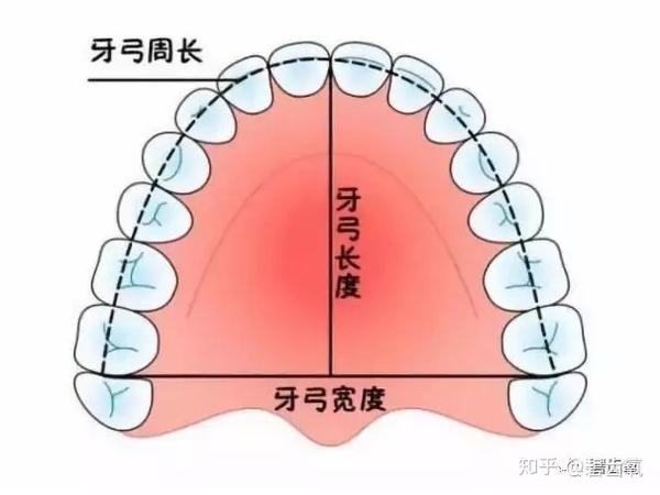 牙弓形态尖而窄则有曲度,更女性化.