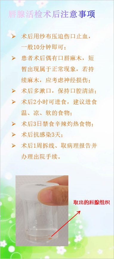 唇腺活检 - 知乎