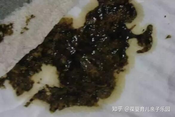 大便暗红色 zhuanlan.zhihu.com