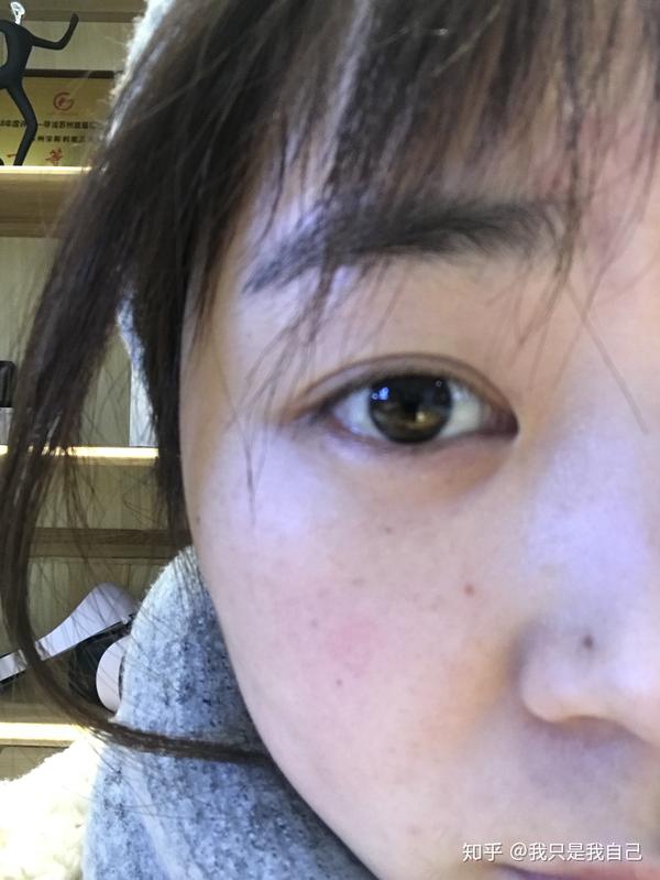 为什么前置摄像头照出来我的脸是歪的?