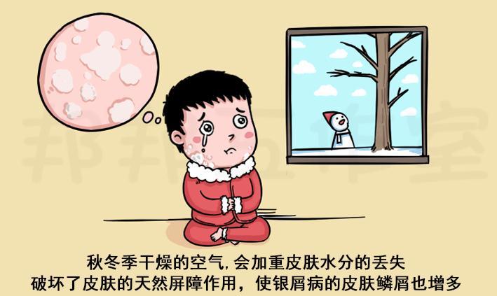 银屑病如何护理才能减轻鳞屑