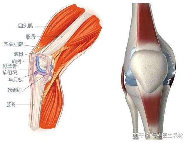 半月板损伤会导致膝关节积液吗