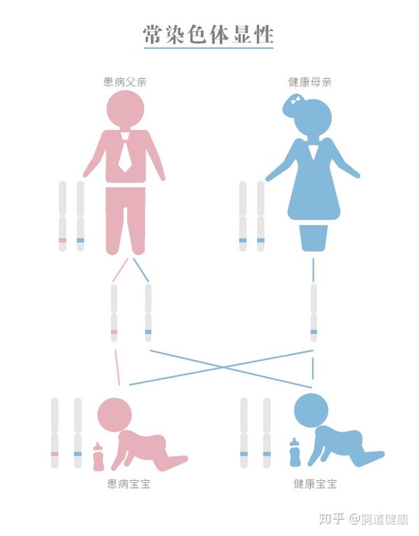 【遗传病科普】强直性肌营养不良