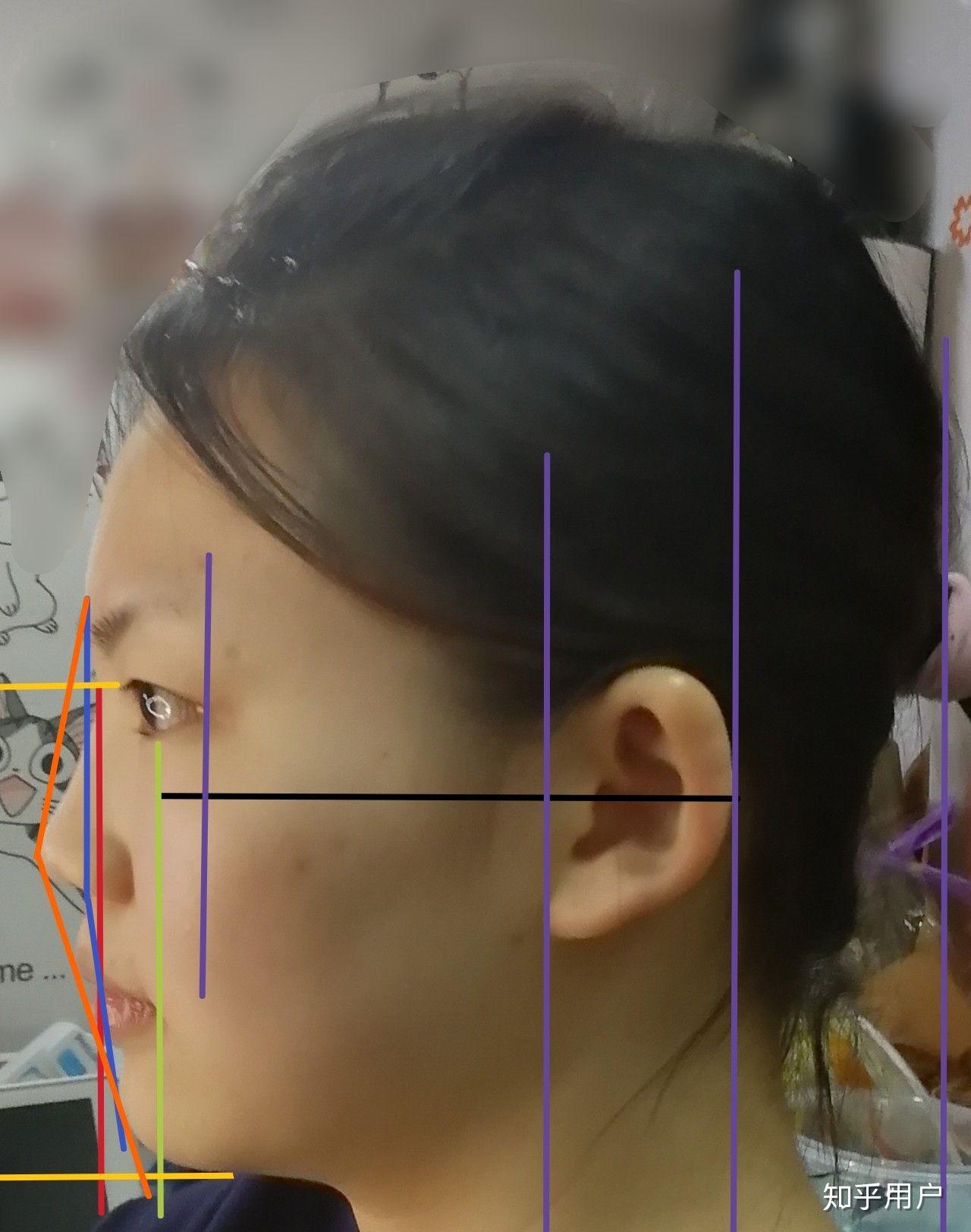 侧脸没正脸好看是什么体验?