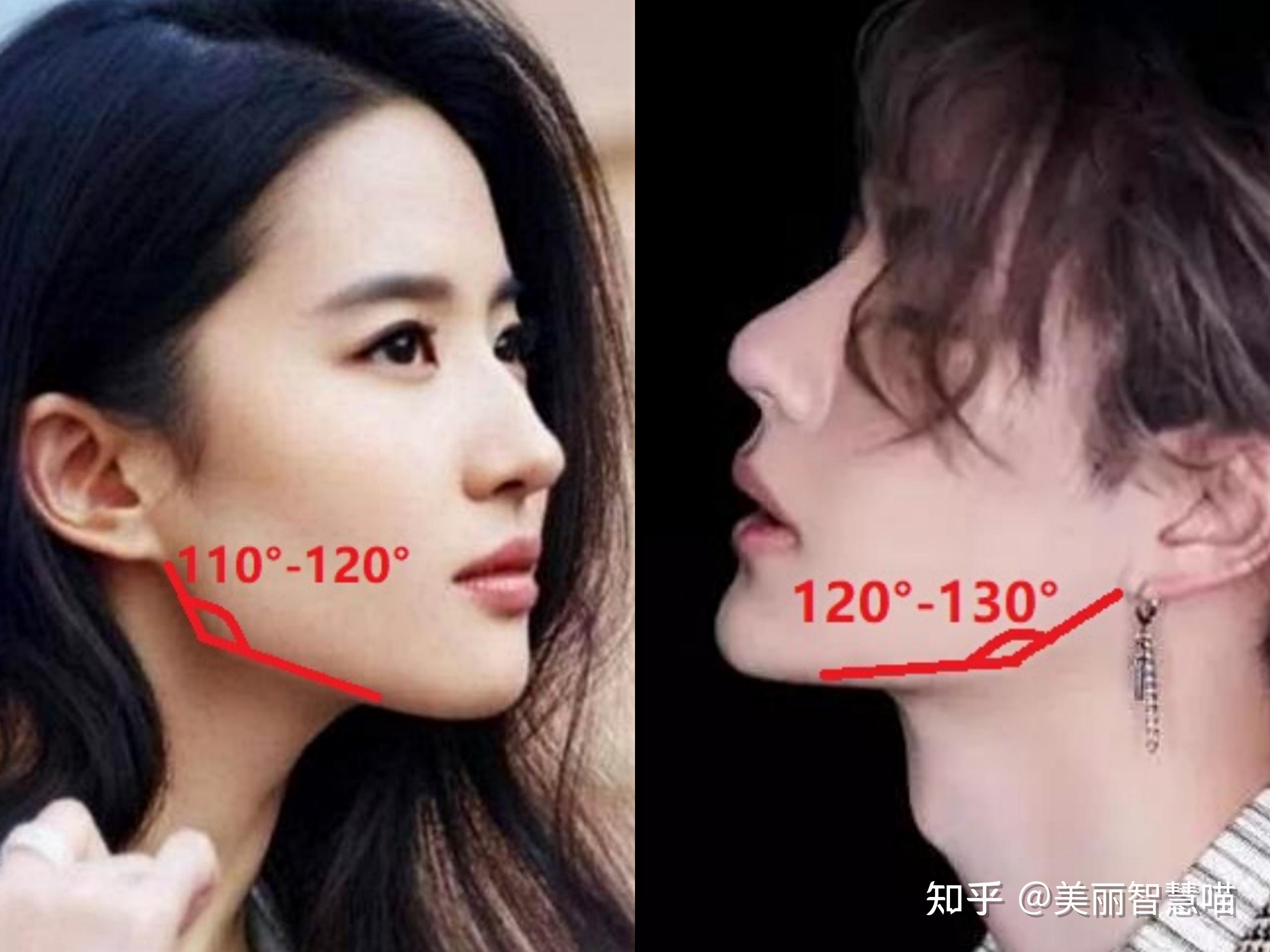 一般来说,比较标准的下颌角角度范围女性的是在110~120°左右,男性