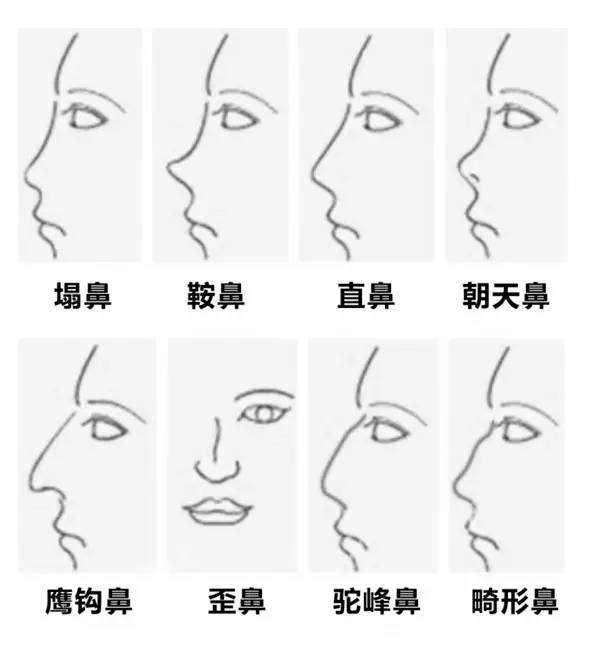 哪些鼻子类型适合做隆鼻手术
