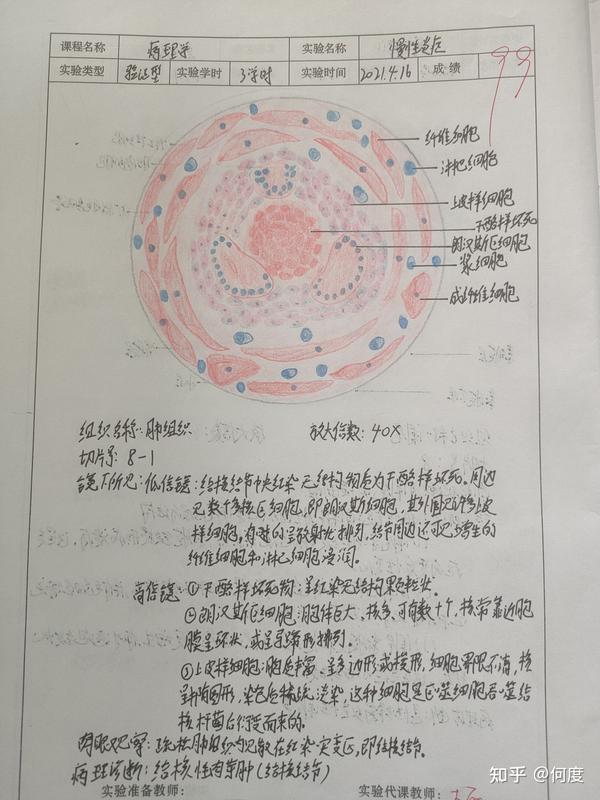 病理实验 红蓝铅笔绘图