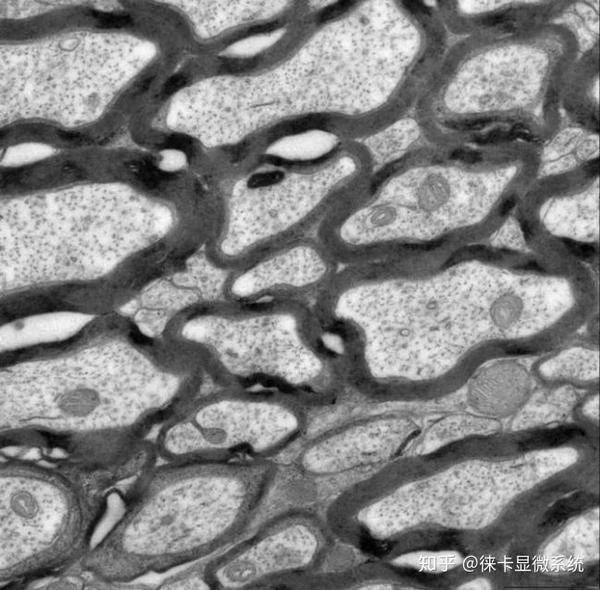 小鼠脑白质有髓神经纤维横断面,低倍透射电镜图