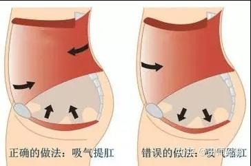 你应该如何正确做提肛练习?痔疮会自己消吗?