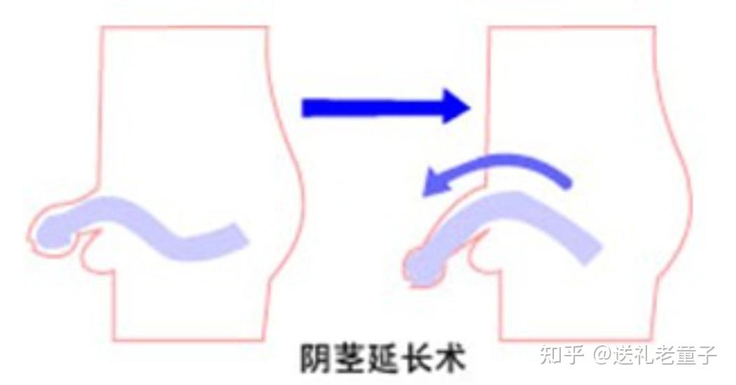 有什么方法能让20多岁的jj变长变粗