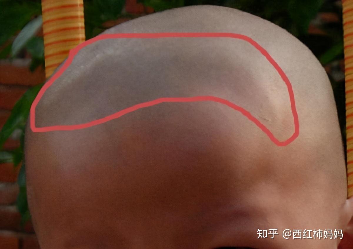 宝宝出生不满3个月,有3个关键部位不能乱碰,恐怕有损娃的健康
