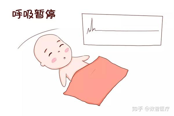 早产儿呼吸暂停是指 37孕周的新生儿(即早产儿)呼吸停顿>20秒,或虽然