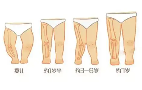 腿拉直,然后紧紧地用小被子包住,防止宝宝长大出现罗圈腿