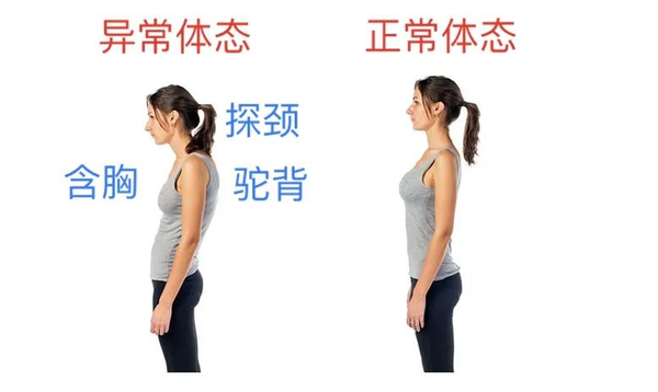 含胸,驼背,圆肩会让你的胸椎曲度变大,不仅侧面变得粗壮,人的体态