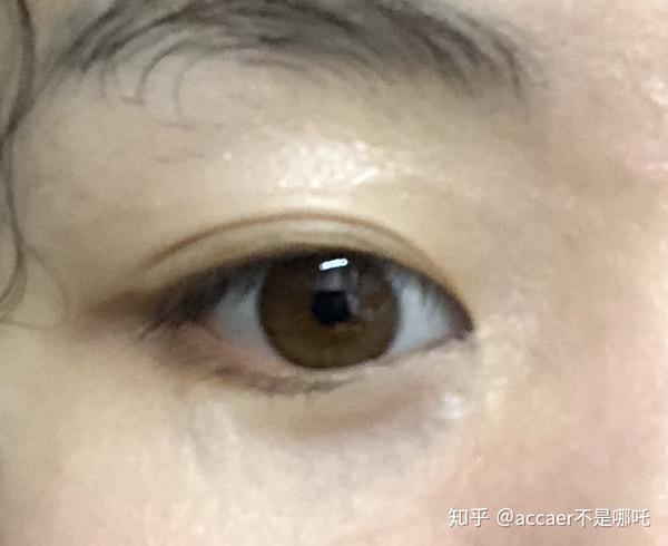 为什么有的中国人的眼珠是黄棕色的.