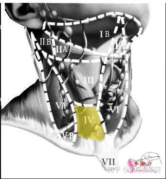 权威,颈部淋巴结分区示意图