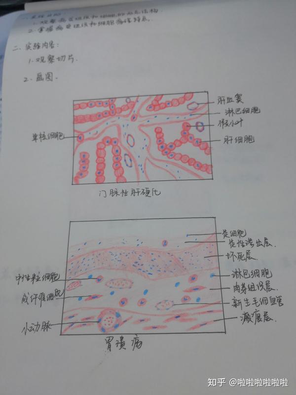 病理学切片红蓝铅笔画