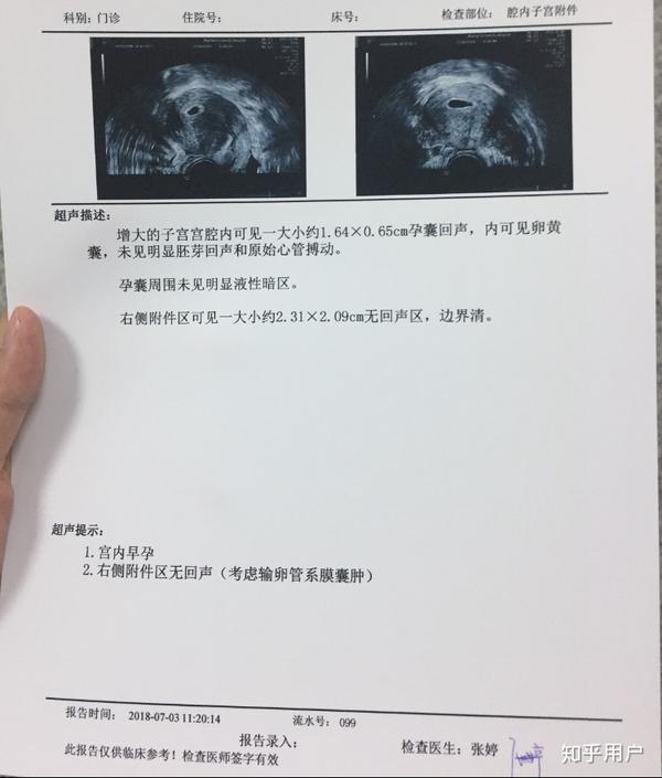 第二次彩超