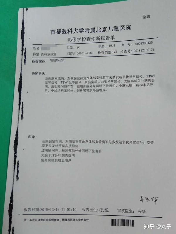 核磁显示灰质异位一定是癫痫吗?