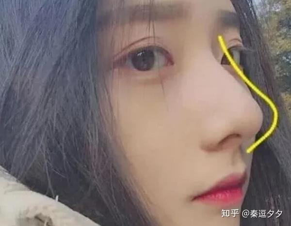 亲妈款鼻子盒鼻微驼峰鼻全都是整形模板简直做得太成功了