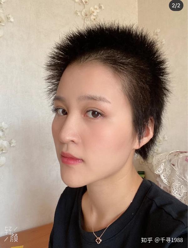 女生光头蓄发过程(已更新7个月长度)