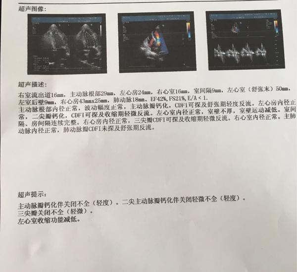 附上我奶奶的心脏彩超报告,希望各位出出主意,发表一下看法,谢谢